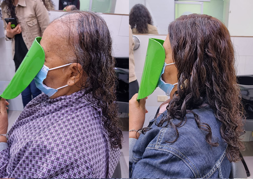 protesis ondulada de mujer